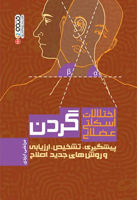 اختلالات اسکلتی عضلانی گردن - تصویر 1