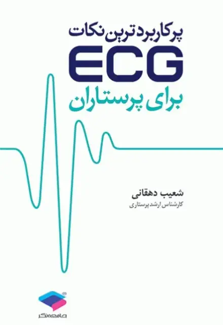 پرکاربردترین نکات ECG برای پرستاران - تصویر 1